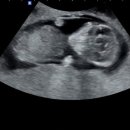 분당우리산부인과의원 이미지