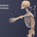 마이밸런스 프라이빗 PT짐 서초점 | [서초동PT,교대역PT] 척추후만증: 서초재활PT, 교대재활운동