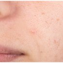 플로레스피부과의원 이미지