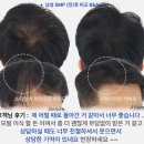 디에이헤어 네이버블로그