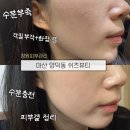 쉬즈 | 마산 양덕동 쉬즈뷰티 피부관리 후기, 창원모공관리 추천