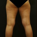 청담마이의원 이미지