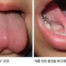 김신향소아과의원 네이버블로그