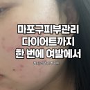 여신 | 마포구피부관리 다이어트 같이 되는 여신의발견 후기