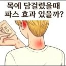 목에 담걸렸을때 파스 효과 있을까? 이미지