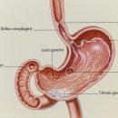 와이메딕스(Ymedics) 이미지