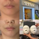 모델링클럽 | [몸짱얼짱뷰티클럽에스테틱] 노원피부관리 토탈에스테틱샵 웨딩케어 1회 후기 하이푸 리프팅 윤곽관리