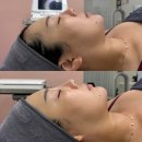 면목동-015 | 사가정 피부관리 브로우니옥 탄력 모공미백 리프팅 관리 후기