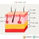 화상[ burn injuries ] 이미지