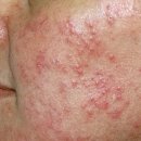 앤봄의원 이미지