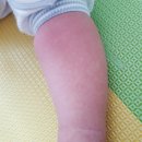 예일소아청소년과의원 이미지