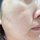 (주)닥터피부광컴퍼니 | 속건조 피부라면 주목! 닥터에스떼 PDRN앰플 리쥬비네이팅 앰플 후기
