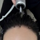 이혈요법 | 강남두피케어 셀비오 강남구청점 두피케어 전문점 이혈테라피 후기