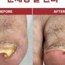 패디히얼