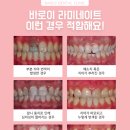 대신치과기공소 이미지