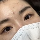 네일잉
