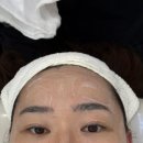 늘미쁨스킨