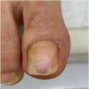 미엘네일닥터아이티엔범계지점 | 안양발톱무좀 꼼꼼하고 친절한 전문 관리샵 미엘네일 닥터아이티엔 범계지점