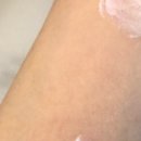 아임메디 이미지