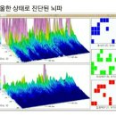 뉴로통상