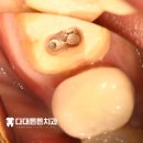 다대치과의원 | 재신경치료로 다시 건강한 치아를 사하구 치과추천