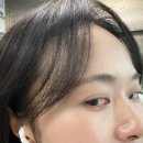 아이멍 | ✨내돈내산 리쥬란아이 아이리쥬란 매우 만족했던 후기 (엠보, 통증, 멍, 붓기, 다운타임, 가격까지!!)😚✨✨