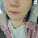 브이핏 | 얼굴붓기관리를 위한 닥터빼브이핏패치 사용후기