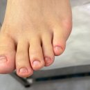 문제성 손, 발 오감네일 | 문제성 발 관리의 성지, 미추홀구무좀 전문 오감네일 방문 후기