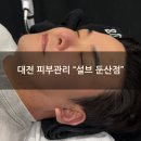 설브 둔산점 | 여드름관리 잘하는 둔산동 "설브둔산점" 솔직후기