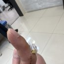 대중병원 | 광주 대중병원 인대 봉합 수술+힘줄 봉합 수술 4주일 후기 !!