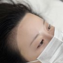 니즈헤어라인