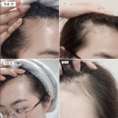 몽실헤어샵 | 정수리가 비어보이는 탈모,강발 HSC 앰플 추천