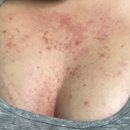 기전공원 | 가드름 미스트 바디워시 가드름 없애는법 실전후기