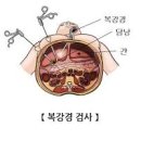 자궁내막증 시술, 임신과 불임난임 ＜자궁내막증 증상원인치료＞ 이미지