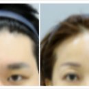 모자이크성형외과의원 이미지