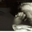 루트의원 | 임신27주차 | 입체초음파 (군자)루트여성의원 후기