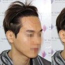 모앤라인성형외과의원 네이버블로그