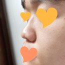 컴플렉스케어 네이버블로그