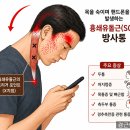 두통·어지럼증·턱관절 통증의 숨은 원인? 흉쇄유돌근(SCM) Trigger Point를 확인하세요! 이미지