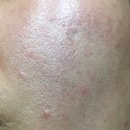 주식회사 보리메디칼 | 촉촉하고 순한 레이덤 토너 써봤어요