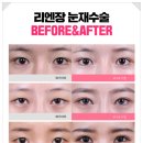 디자인성형외과의원 이미지