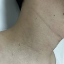 서영빌딩 | 통영 '더스킨&amp;더브로우' 실면도로 쥐젖 &amp; 편평사마귀까지 한번에 제거 가능해요!