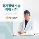 서울 하지정맥류 병원, 하지정맥 수술은 언제 해야 할까 이미지