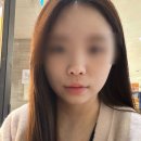 청담피부과 온웨이브 소프웨이브 온다리프팅 효과 본 후기(통증, 가격)