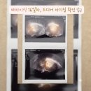 난임극복 임신성공을 위한 준비해야 할 모든 것 | 배아이식 16일차, 드디어 아기집 확인 🐑