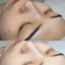 연제구-155 | 부산 슈퍼젝션 전문점 웨더스킨 | 세멘시트 관리 후기!