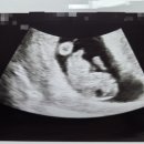 구림보건지소 이미지