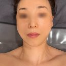 라티아라 | 수원피부관리 어디로 갈까 고민된다면? 애띠애 피부관리 골근동안 윤곽관리 후기