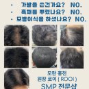 머리꽃 피우다 이미지