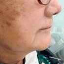 이지(EZ)치과기공소 | 일산 틀니 잘하는 치과? 이렇게 잘 할 수 있을까??